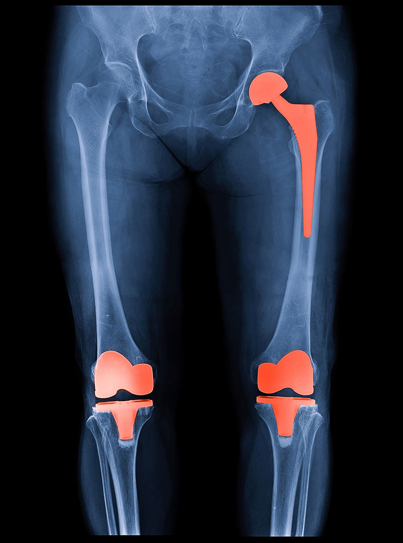 x-ray of a practical services patient of outpatient orthopedics